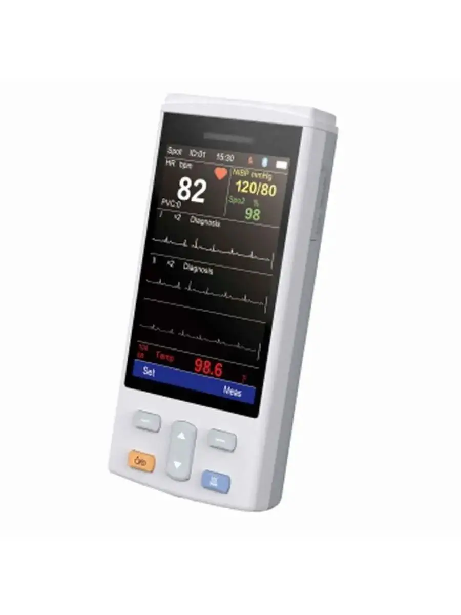 M6 4.3 Inch Portable Veterinary Multiparameter Monitor with SPO2, ECG, NIBP, TEMP 1005009104517755