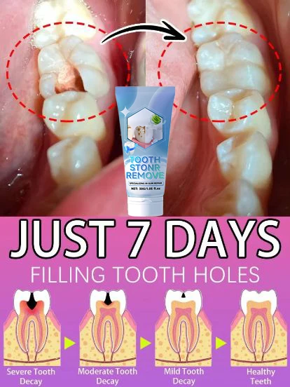 Contains Probiotics to Repair Tooth Decay and Clean Teeth 1005009132941417