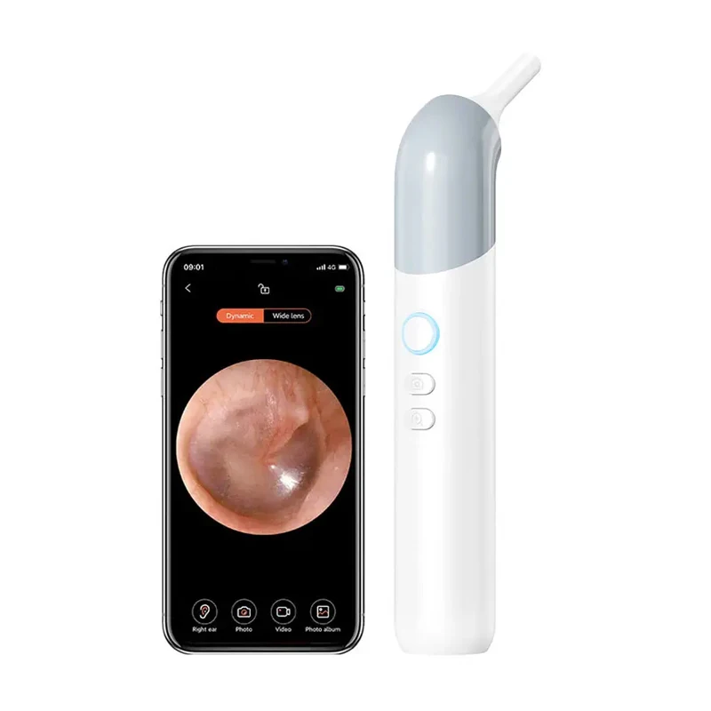 Smart Ear Cleaner with HD Camera - Care Removal Kit & Pet/Dog Cleaning Detector Device (3 In-1) 1005009998950069