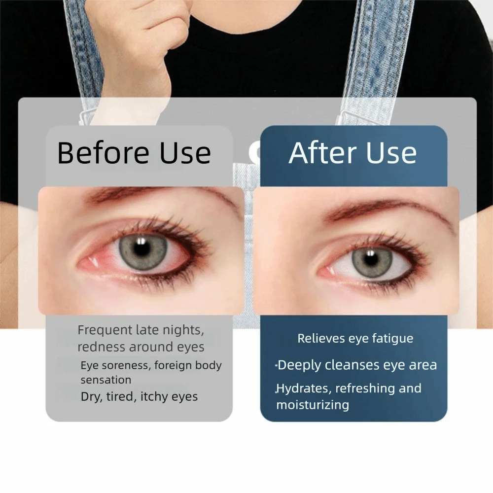 Modes Adjustable Electric Eye Wash Cup IPX5 Waterproof Relieves Fatigue Ultrasonic Eye Cleaner 1005011668146087